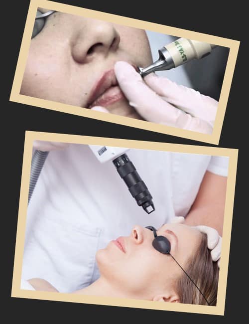 видалення перманентного макіяжу