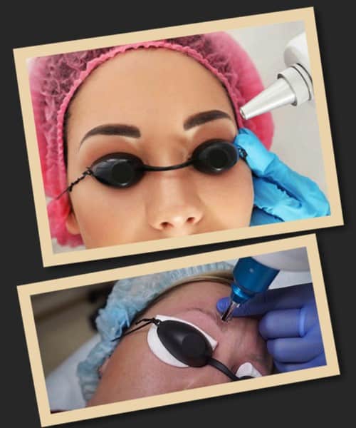 Чинники, що впливають на вартість виведення татуажу