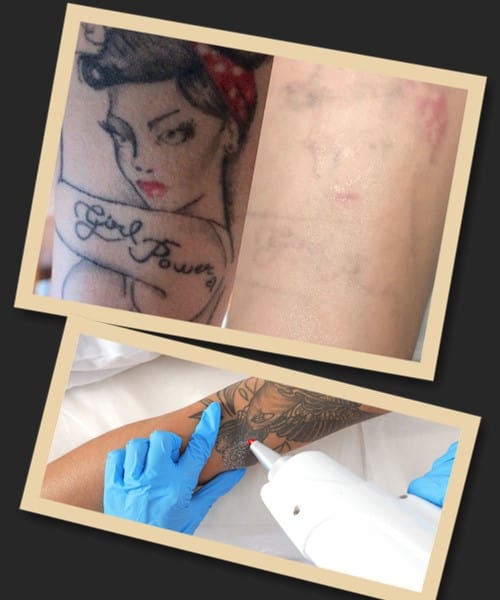 прибрати тату ціна