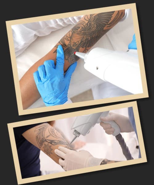 вивести тату за один сеанс