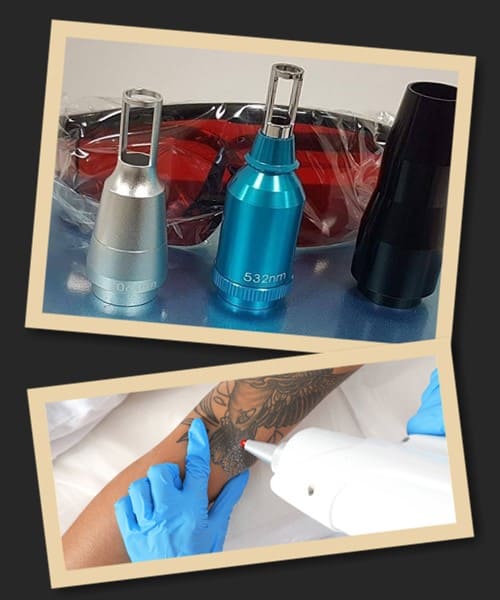 лазери для видалення татуювань