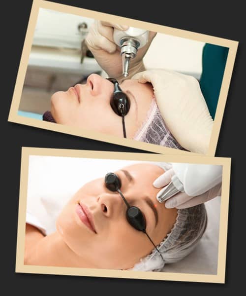 видалити перманентний татуаж брів