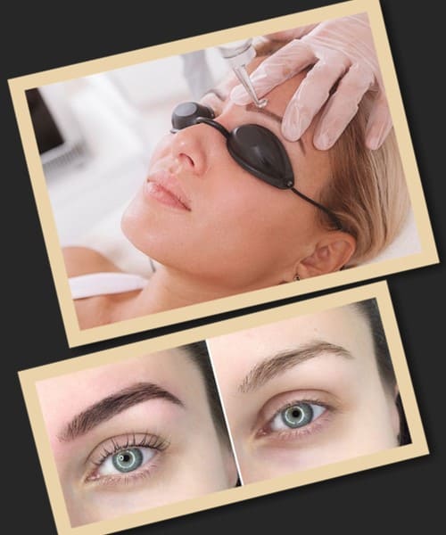 Чи безпечно виводити татуаж очей лазером?