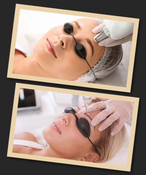 Вартість видалення перманентного макіяжу брів