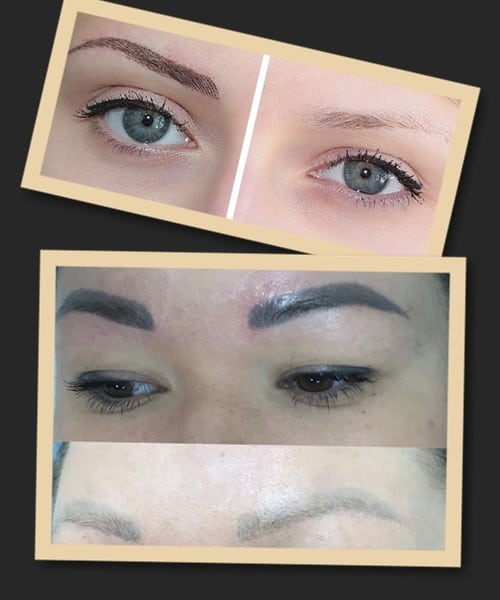 Перед видаленням татуажу