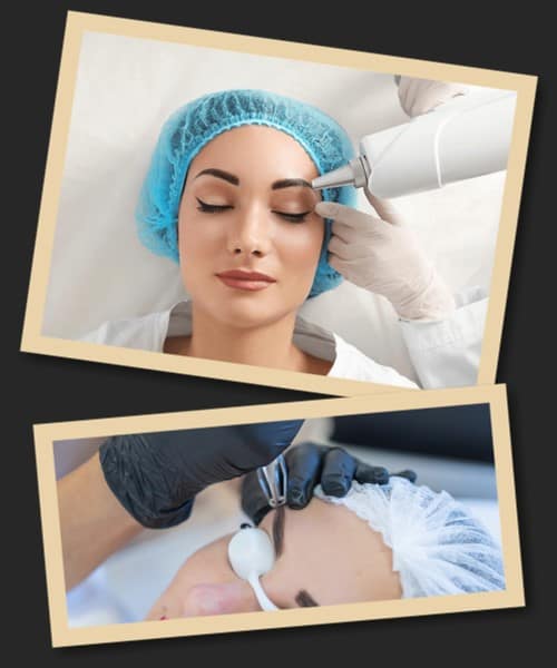 видалення татуажу очей