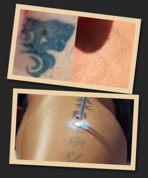 Найшвидше вивод тату