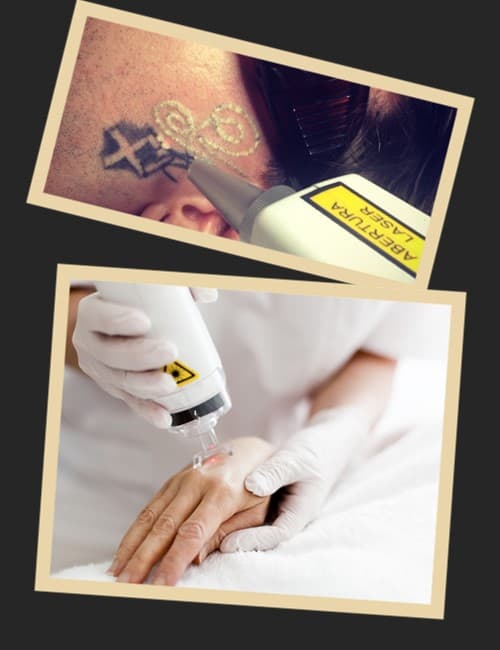 Типи лазерного обладнання