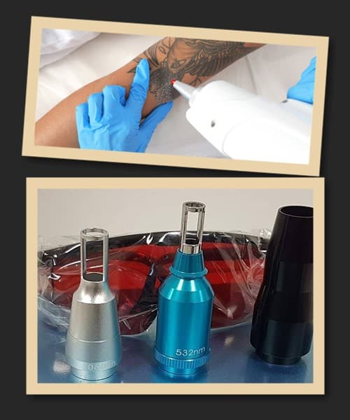 Лазерний метод видалення тату