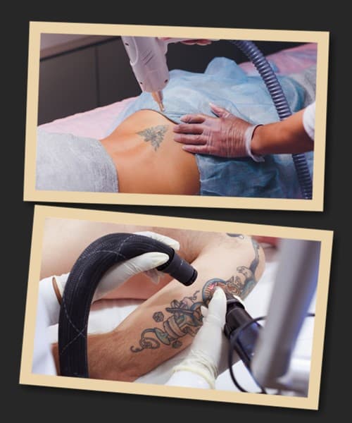 Методи виведення тату