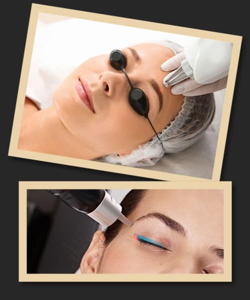 Лазер – найкращий метод виведення татуажу