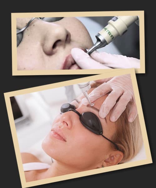 Якість виведення татуажу