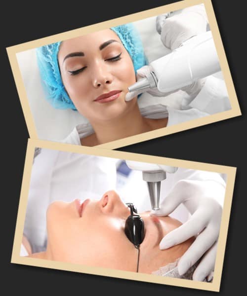 Чому лазерне видалення татуажу – найкраще