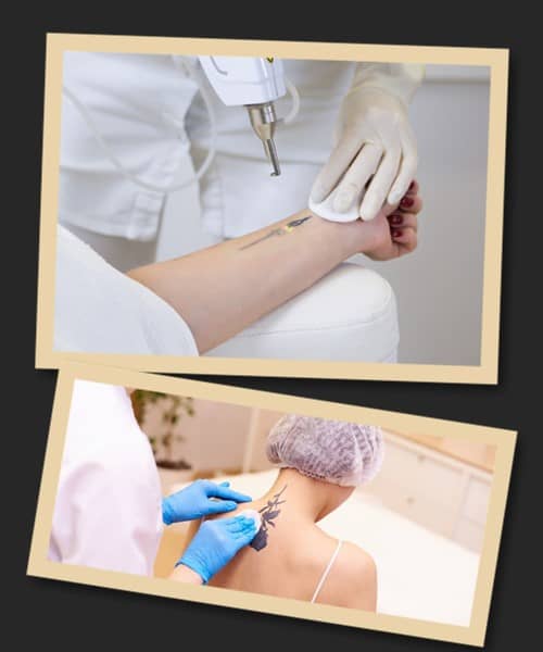 Яким чином зводять татуювання