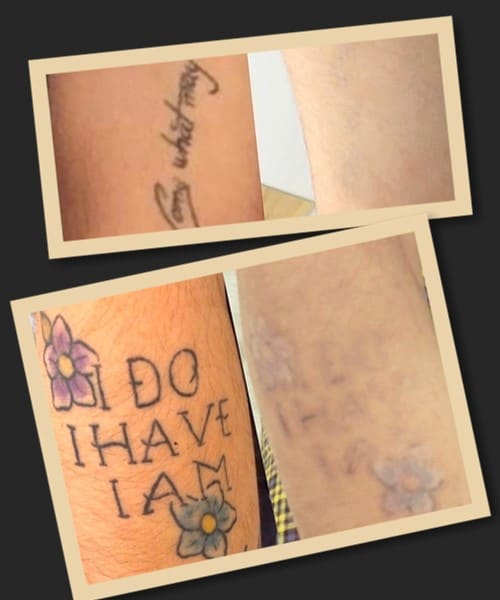 Методи зведення тату