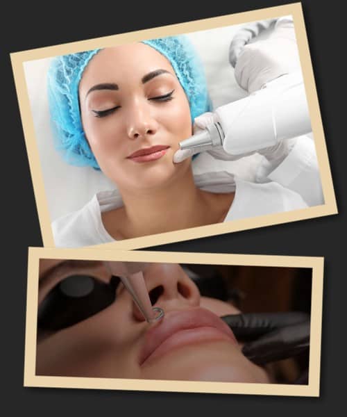 Як видалити перманентний макіяж губ