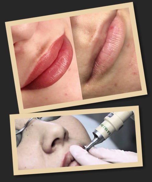 Як виправити невдалий татуаж губ