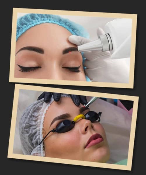 Як можна видалити татуаж брів