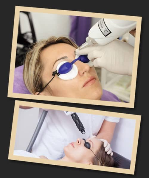 Способи видалення татуажу брів