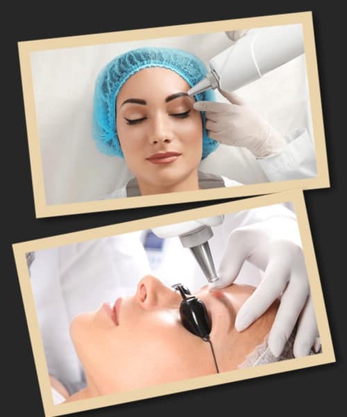 ефективність лазерного виведення татуажу брів