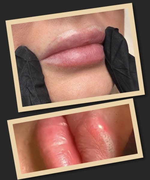 Як можна виправити невдалий татуаж губ