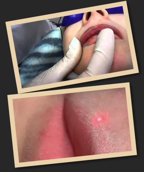 Як повністю видалити перманентний макіяж