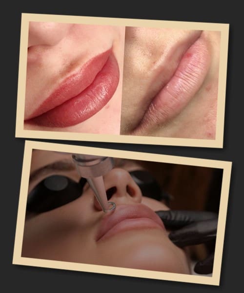 Як вивести перманентний макіяж губ