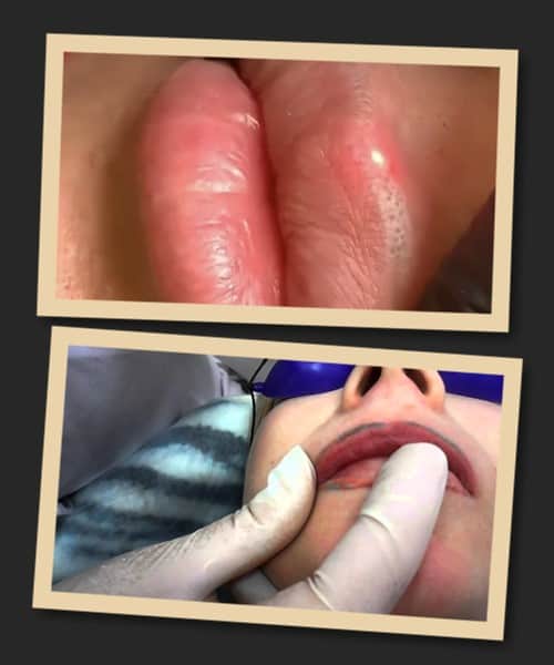 Способи виведення перманентного макіяжу губ