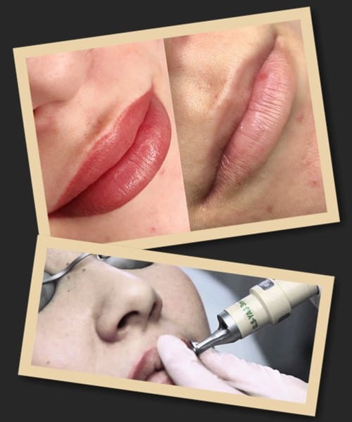 Як можна вивести татуаж губ