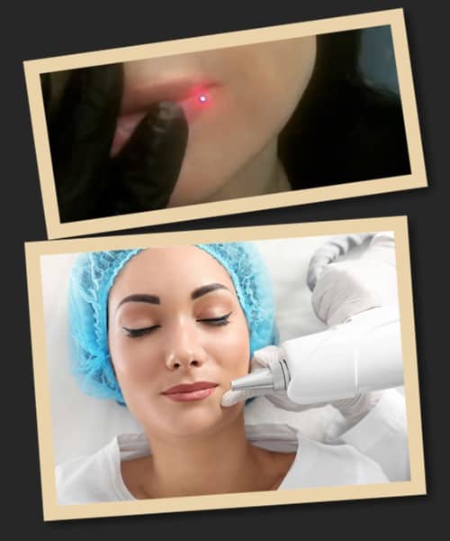 вести татуаж губ в Києві