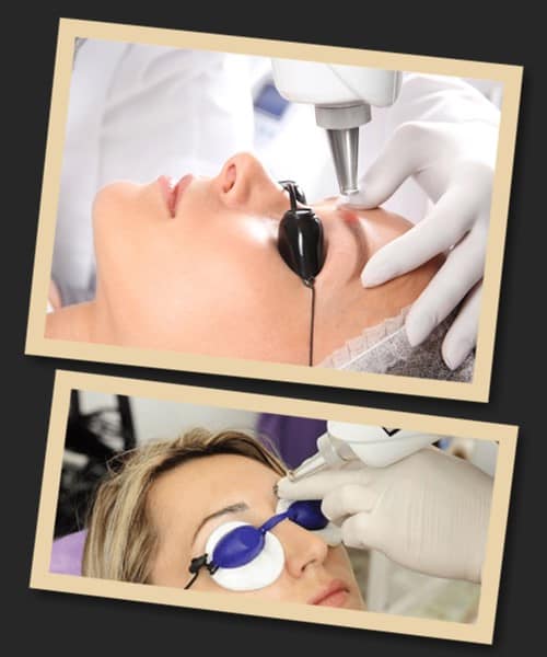 ефективність видалення татуажу брів