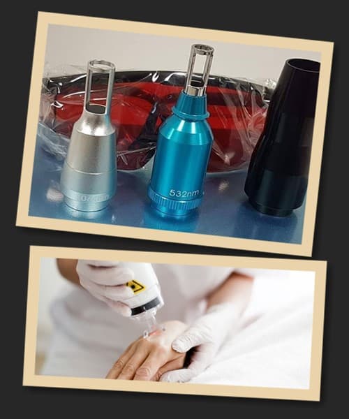 Лазерне видалення тату