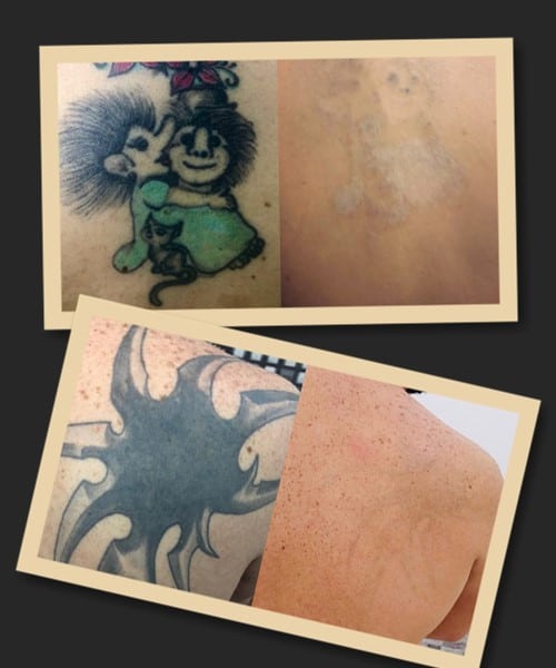 зведення татуювань