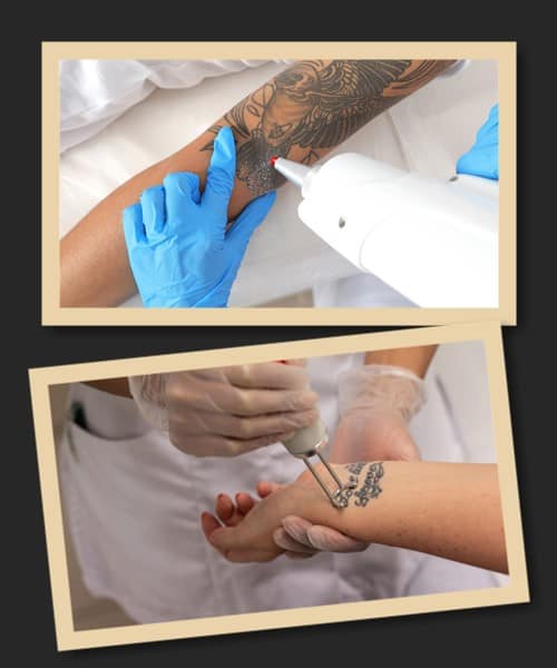 Ціна зведення татуювань