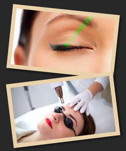 ефективність лазерного видалення татуажу