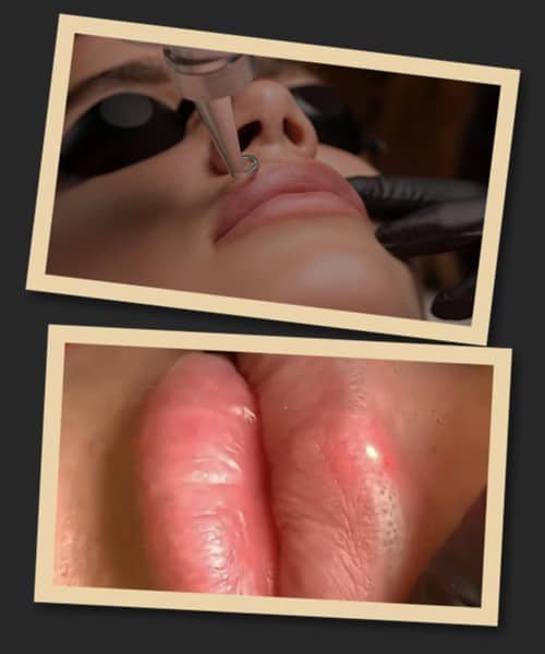 прибрати татуаж губ