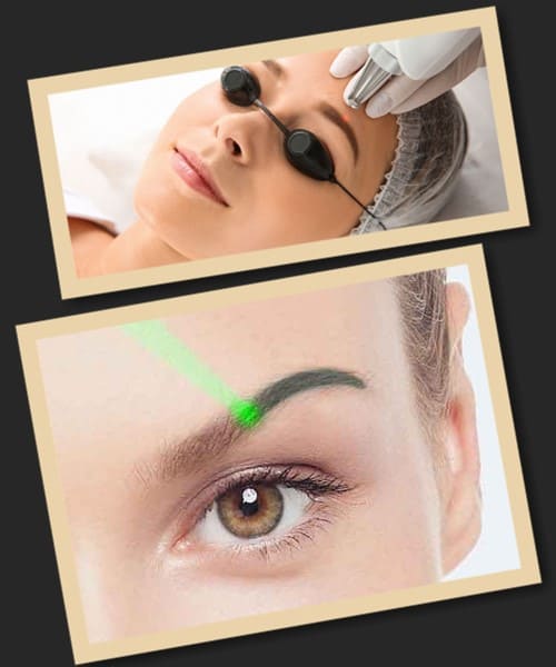 Які методи підходять для виведення татуажу