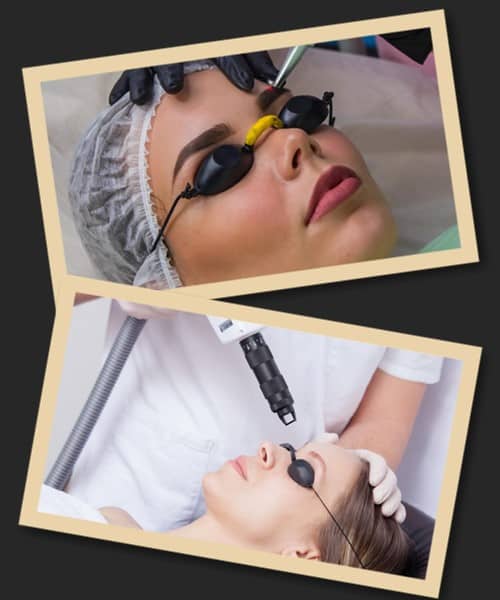 підготовка до лазерного виведення татуажу