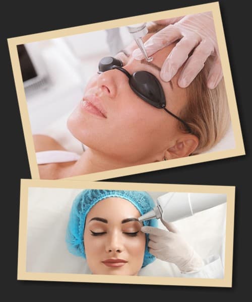 повністю вивести татуаж