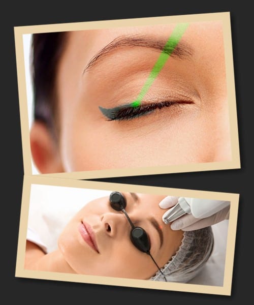 Видалення перманентного макіяжу неодимовим лазером