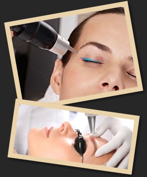 Видалення перманентного макіяжу