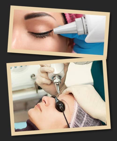 виведення перманентного макіяжу