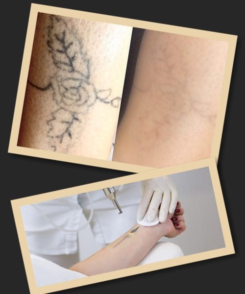 салон для зведення татуювання