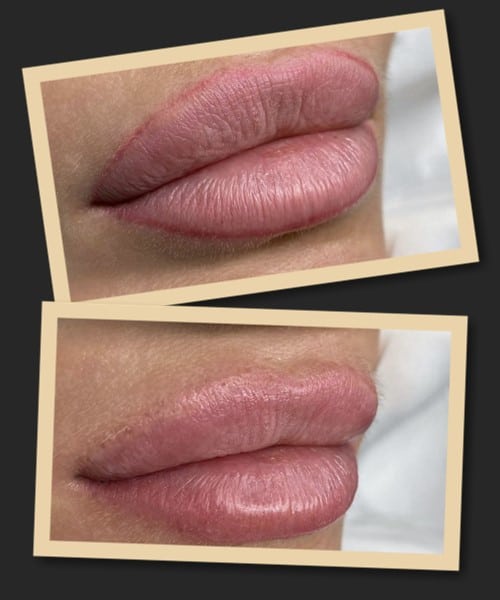 Що робити з невдалим татуажем губ?