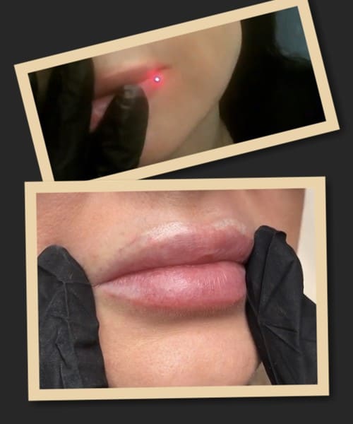 видалити перманентний макіяж губ