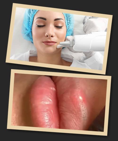 ефективність видалення перманентного макіяжу лазером