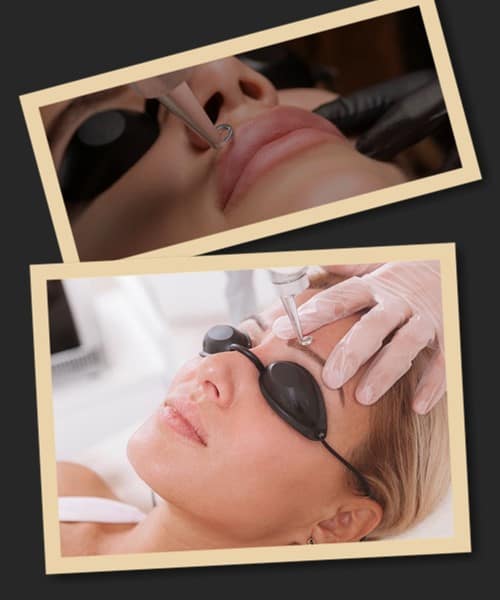 видалення перманентного макіяжу