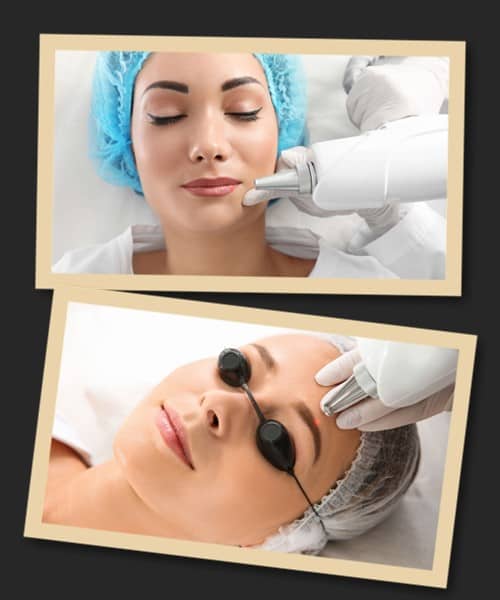 Видалення перманентного макіяжу за допомогою лазера