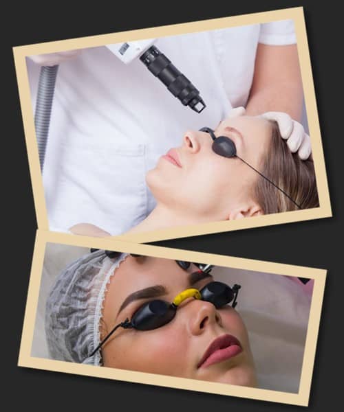 Популярні методи виведення татуажу