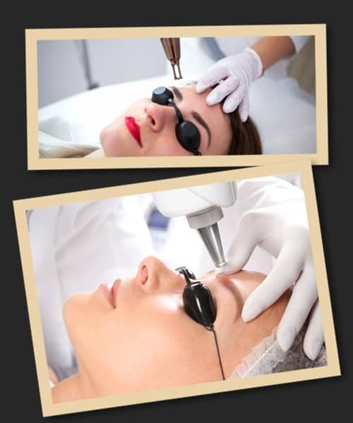 видалити татуаж брів